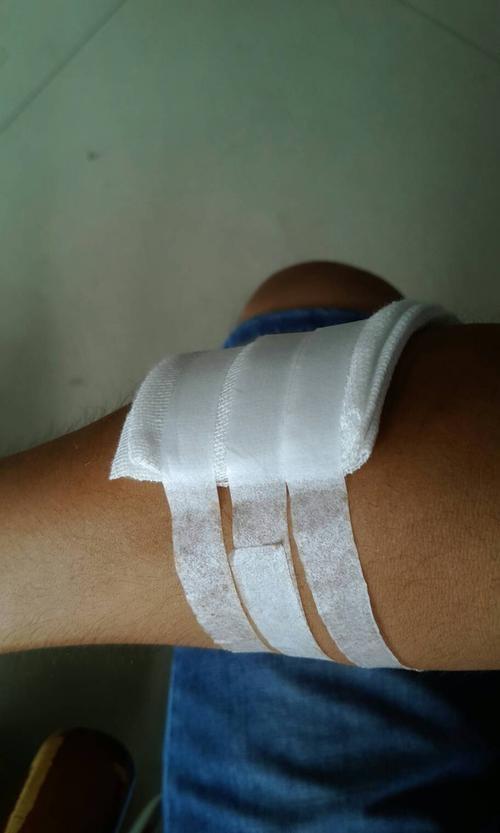 包扎腿部伤口图片