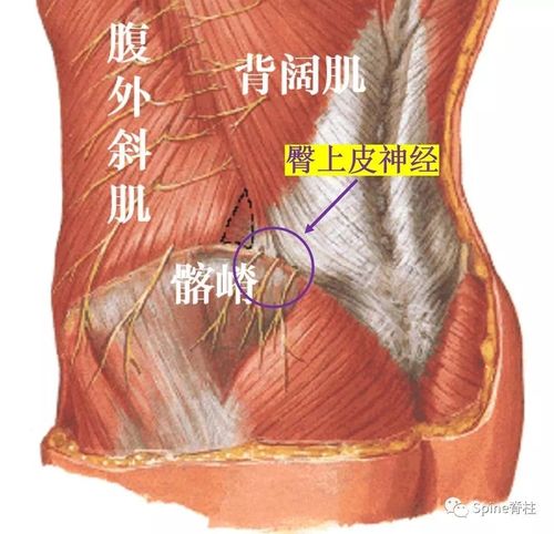 容易忽略的疾病 - 臀上皮神经卡压综合征