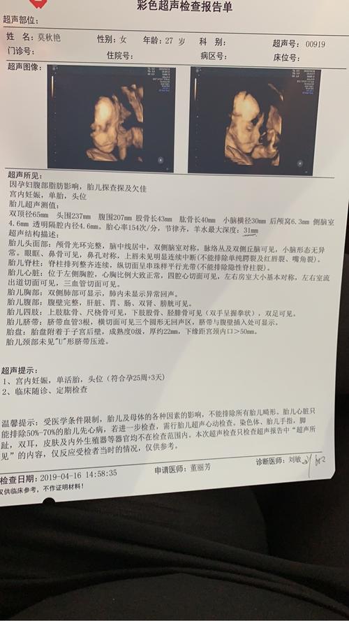 大家帮我看看这个四维有没有问题,嘴巴好像有东西?兔