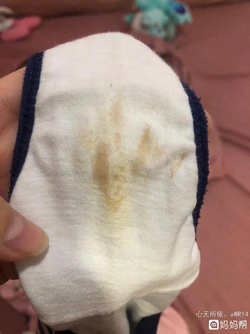 怀孕6周多褐色分泌物老是反反复复隔两