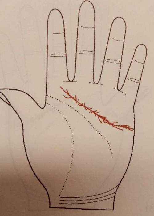 感情线上有斑点或小线缠绕