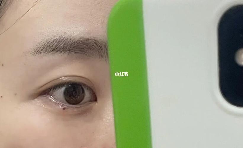 丝状疣终于消失啦05_摄影_spa_医疗健康_医疗健康