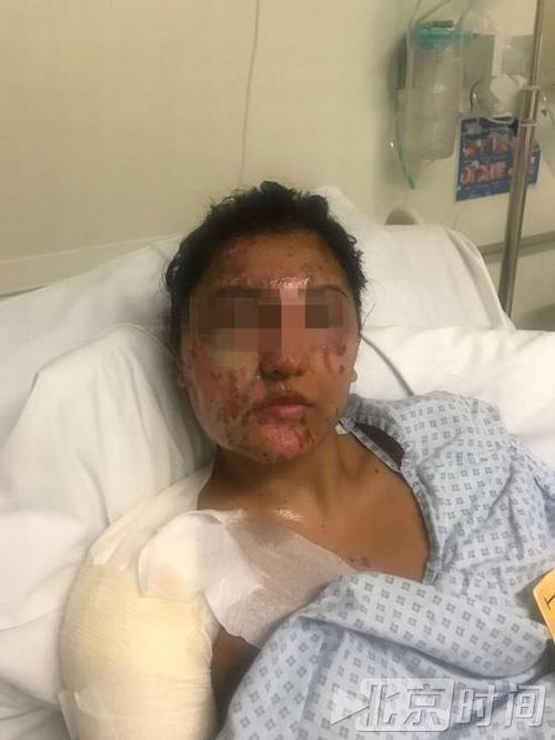 21岁女生遭人泼硫酸严重毁容 4个月后奇迹恢复美貌