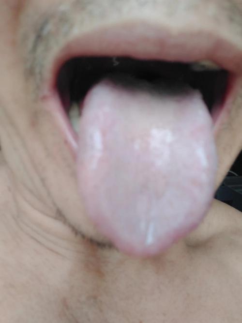 中医舌诊之肝郁 怎么表现化火或寒湿 如何在舌苔上看出肝郁伤脾