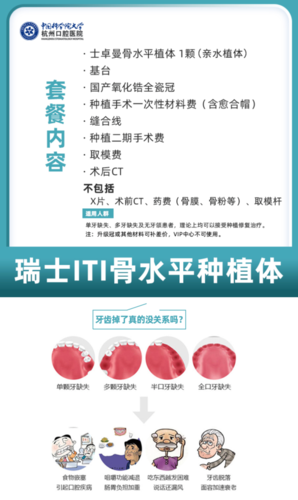 杭州口腔医院 瑞士进口士卓曼iti骨水平种植牙