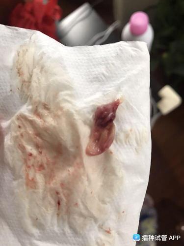 移植成功后,掉出来一个这个东西,是什么呀,胚胎吗