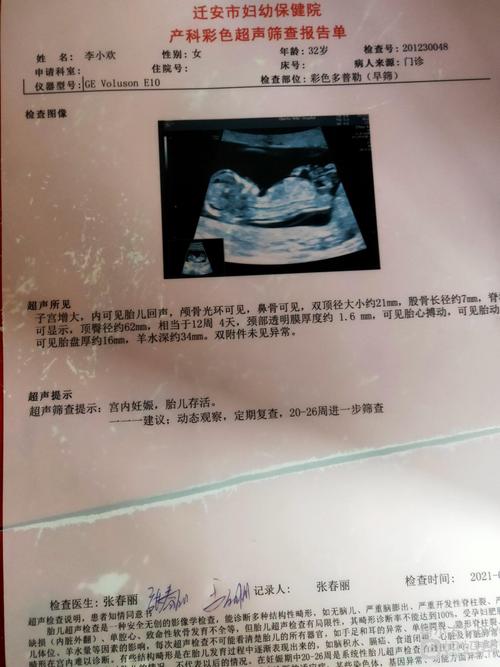 今早上秒过的nt,懂得姐妹看看是不是男孩