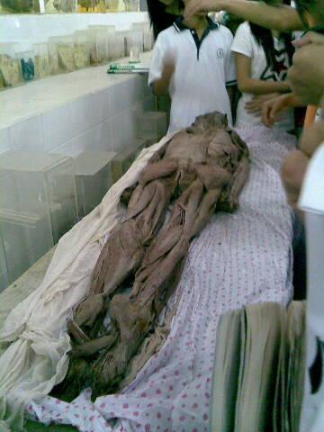 通常情况下,人体死亡之后,体内细胞会开始其自溶过程,细胞中的 a