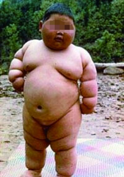 除了影响智商,还影响生殖健康