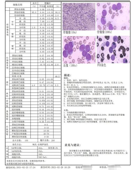 (1)骨髓细胞形态学分析报告提示:急性髓系白血病骨髓像(按fab分类法