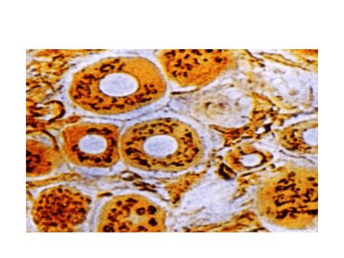 高尔基复合体.pdf 31页