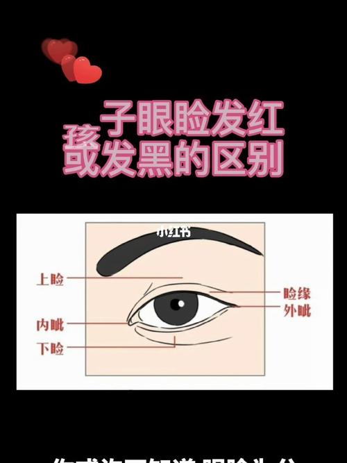 你家宝宝是否也有眼睑处发红,发黑或发青的现象?