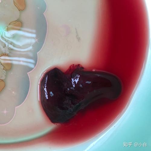 怀孕53天超药流时间 孕囊偏大 没清宫 其实没那么害怕