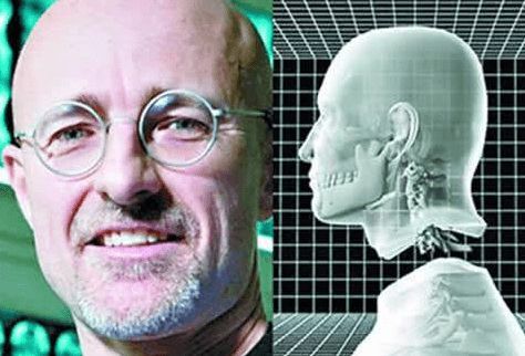 记得当年很火的换头手术吗?俄罗斯瘫痪小伙自愿参加,后来如何?