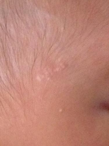 宝宝出生时就有,类似脂肪粒堆积在一起,不知道是什么