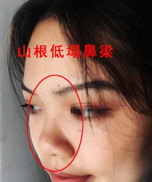 塌鼻梁面相1,面大鼻小塌鼻梁的女性自信心不足面相中鼻为财帛宫,代表