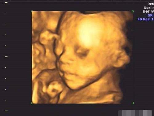 孕妈四维产检是女宝,几番努力生下男宝,怀疑是不是抱错了