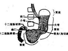 胃窦动力低下是胃轻瘫的临床表现.