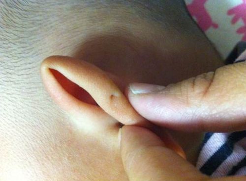 为何有些人耳朵上有小孔?农村俗语"前仓粮,后仓糠"有道理吗?