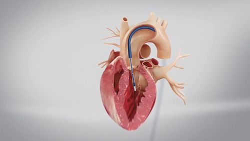 vj师cg医学3d人体心脏三维机理动画_1280x720_高清(:)