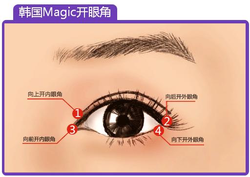哪些人不能开眼角