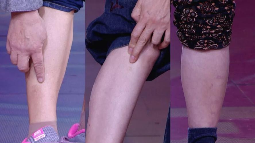 养生堂今日1725播出观下肢识糖斑