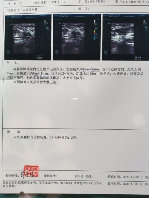 乳腺囊肿第三次彩超_解放军九五八医院自由行热门攻略