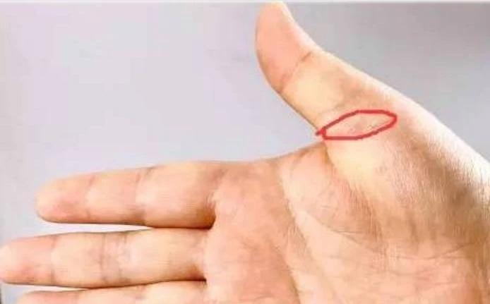 你手上有个"专治各种不通"的穴位,每天按按,血管通畅心情好!