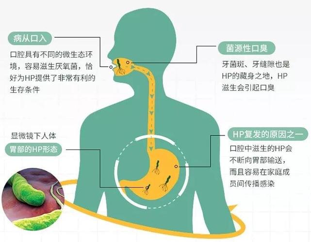 日常应如何预防幽门螺杆菌感染?