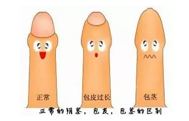 的,也就是说,阴茎头部都是在包皮的包裹之下的,我们称之为生理性包茎