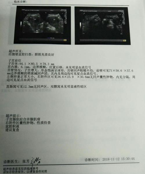 中医人关于"子宫腺肌症"的交流分享