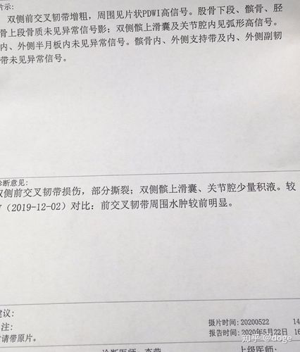 膝盖前交叉韧带损伤医生推荐保守治疗我还能继续跳街舞吗