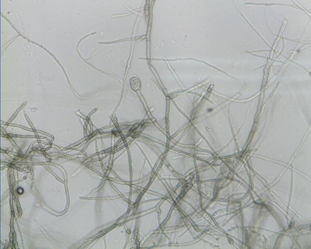 菌丝有部分发生膨大,如下图.孢子着生位置不知.