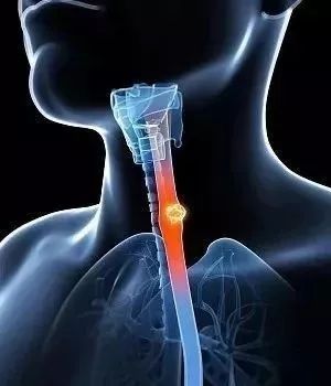 三种坏行为正在把人往癌症里推,快看看吧!