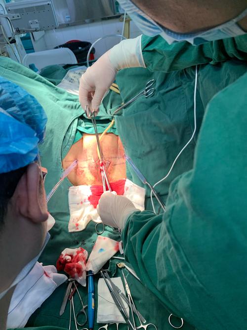 tvt-o术,经闭孔经阴道前壁尿道悬掉术