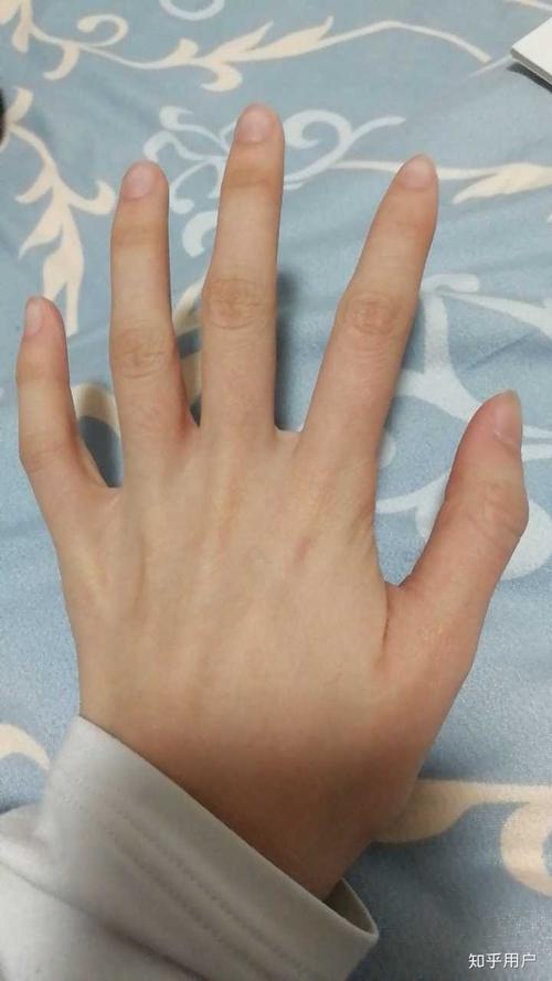 女生如何才能有个骨节分明的手