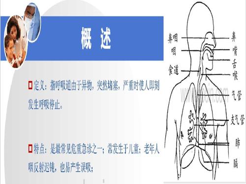 气道梗阻课件ppt