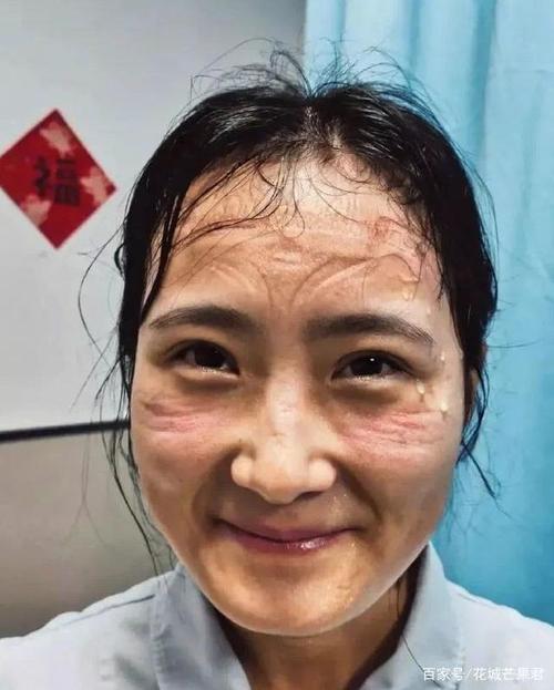 防护服下汗湿浸透的护士