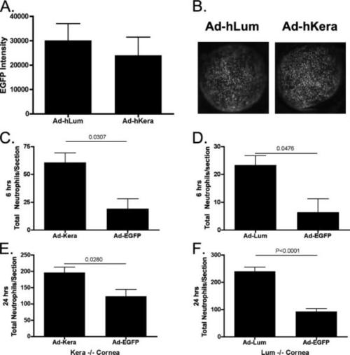 and lumican regulate neutrophil infiltration and corneal clarity