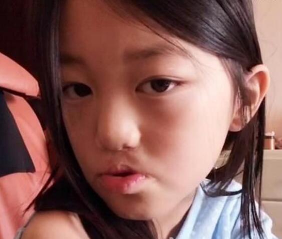 【图】王菲女儿李嫣兔唇照片曝光 揭秘其兔唇引起的原因