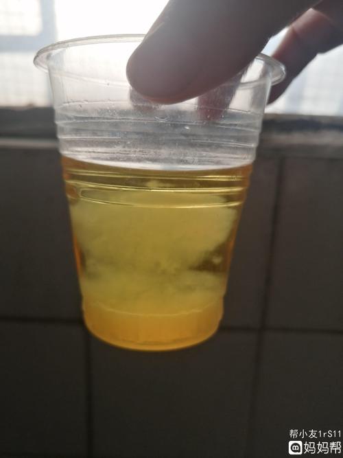 酒精测男女,哪位宝妈验证过的?知道这是女