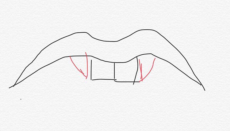 红色的就是两个虎牙