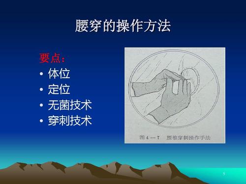 腰穿的操作方法 要点:   体位   定位   无菌技术   穿刺技术