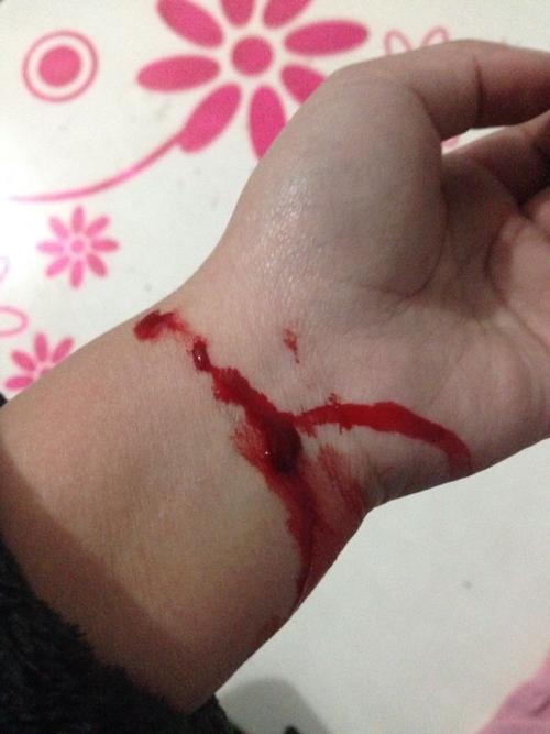 已经割了一次腕了,天太冷,我住的地方没暖气血凝固住了,没死成