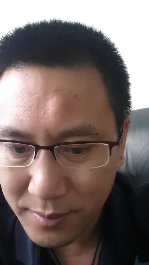 问:医生,你好,我额头上长了一个很硬的包,像是里面的骨头隆起一样,很