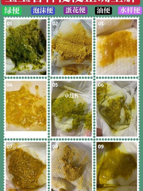 宝宝便便大全全面解析,宝妈少走弯路_肠道蠕动_腹泻_肠道_消化不良