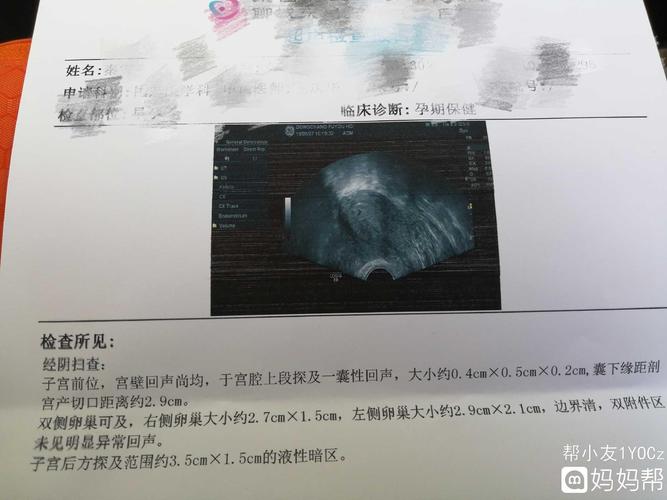 怀孕36天去做的b超和抽血,大夫说hcg
