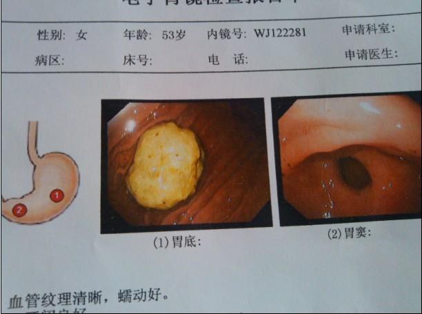 形状多为圆形或椭圆形,大小不一,小的如乒乓球,大者似婴孩头.