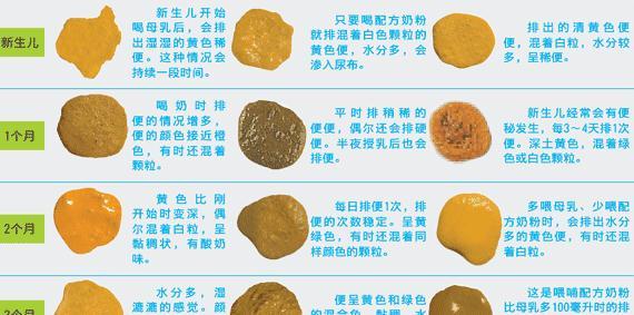 便便能反映宝宝健康?5种颜色6种形状,告诉你宝宝的健康情况