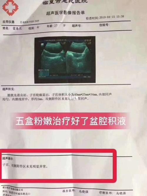 盆腔积液_妇科_盆腔积液_医疗健康_医疗健康其他